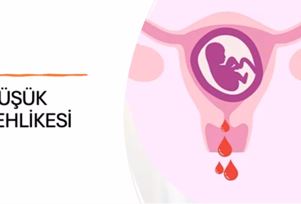 Düşük Tehdidi — Doç. Dr. Deniz Şimşek, Bursa