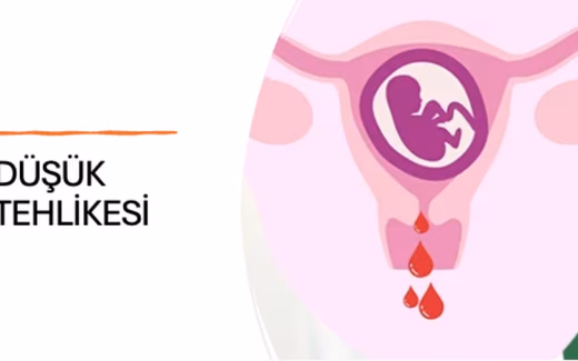 Düşük Tehdidi — Doç. Dr. Deniz Şimşek, Bursa