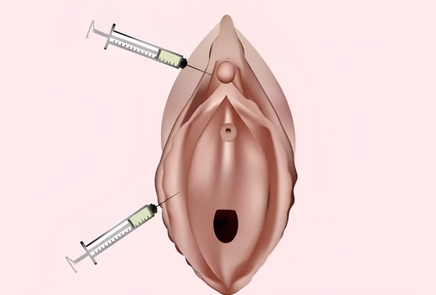 Orgazm Aşısı — Doç. Dr. Deniz Şimşek, Bursa