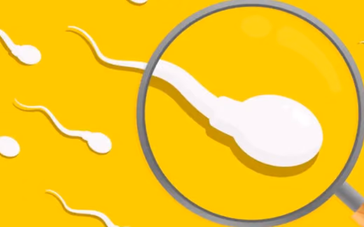 Spermiogram (Sperm Testi) — Doç. Dr. Deniz Şimşek, Bursa