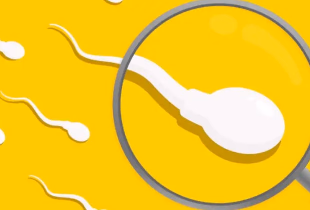 Spermiogram (Sperm Testi) — Doç. Dr. Deniz Şimşek, Bursa